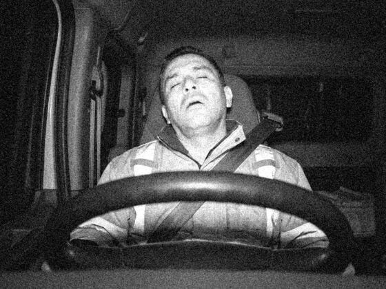 Severe fatigue